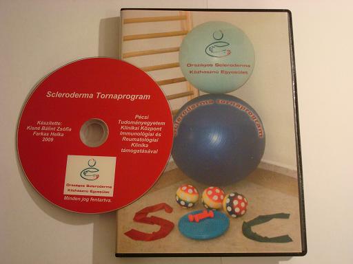 SCLERODERMA TORNAGYAKORLATOK MÁR DVD-N IS